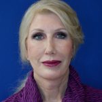 after facelift and neck lift front view of female patient 4478