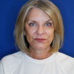 after facelift and neck lift front view of female patient 4768